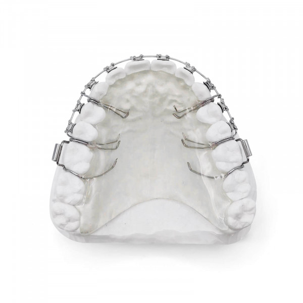 Retainer with Brackets