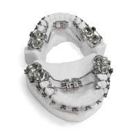 Bracket Apparatur mit RPE