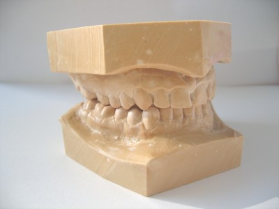 3D Dental Model (Upper &amp; Lower Jaw)