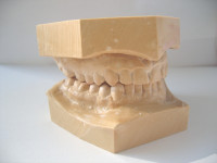 3D Dental Model (Upper & Lower Jaw)