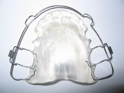 Wrap Around Retainer