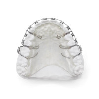 Retainer mit Brackets