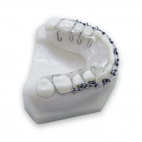 Retainer with Brackets