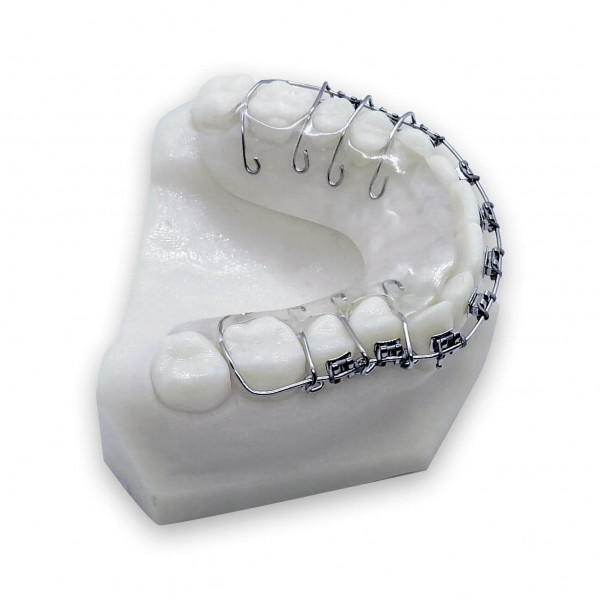 Retainer mit Brackets