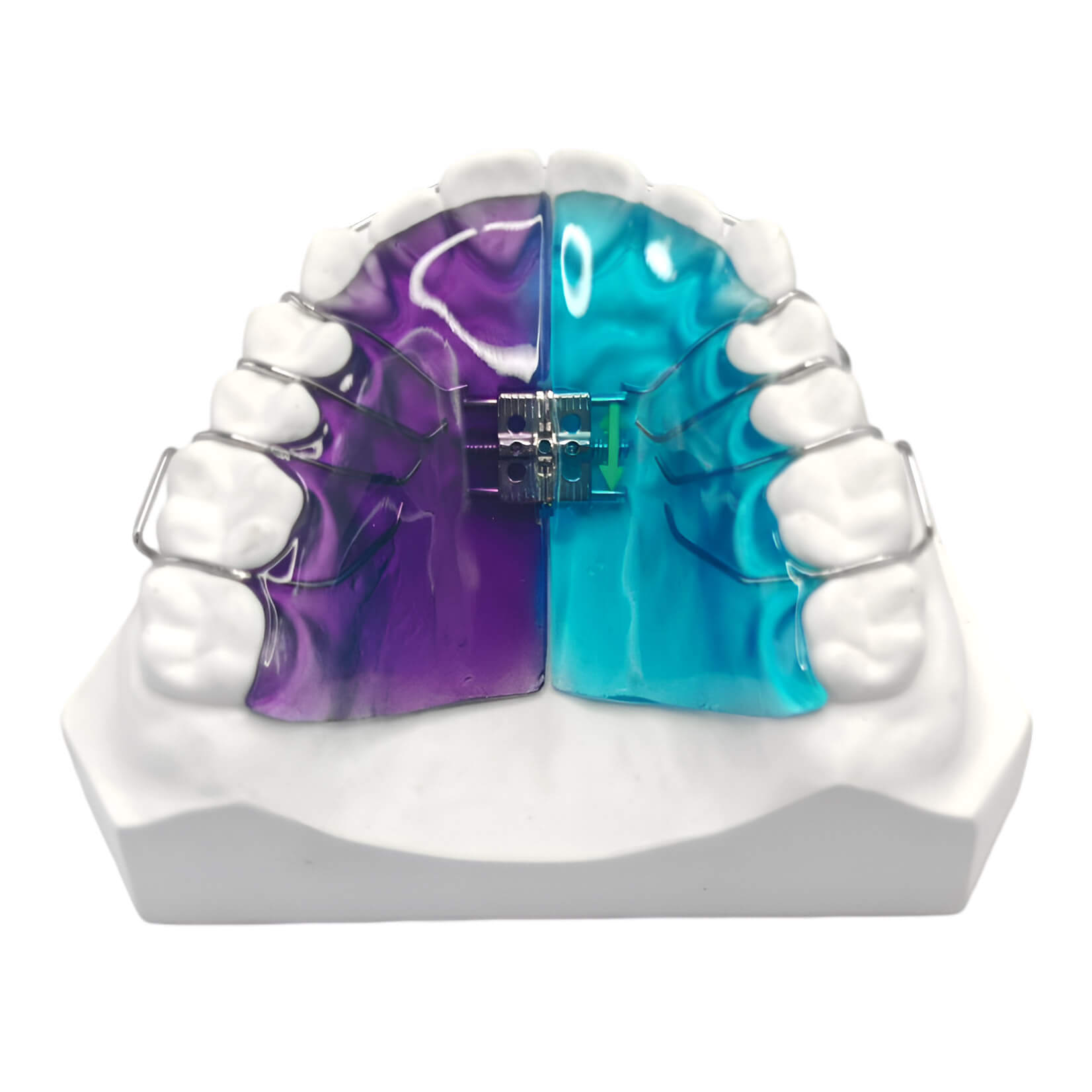 Buy Schwarz Appliance Online - Palate Expanders - BracesShop.com