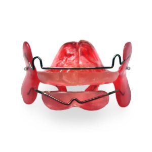 Modified Bionator with Cheek Shields