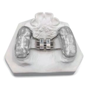 Rapid Palatal Expander (RPE)