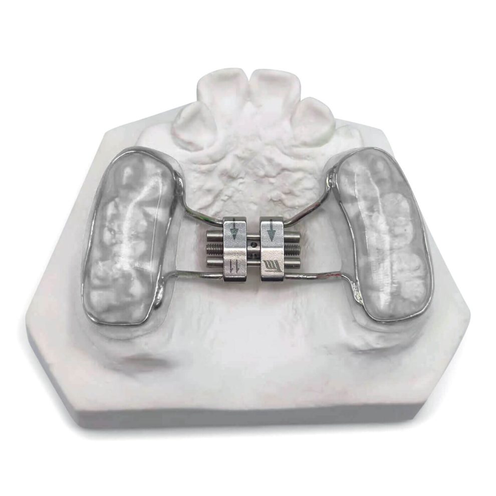 Buy Palate Expander Online | Expanders - BracesShop.com