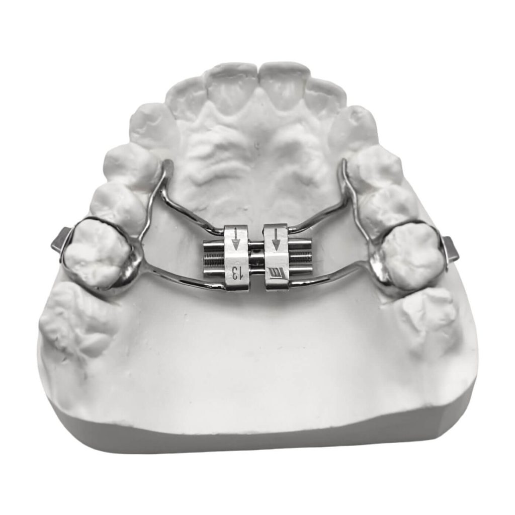 Narrow Rpe Rapid Palatal Expander (RPE) - BracesShop.com