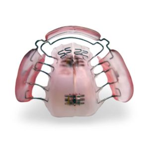Expansion Plate with Cheek Guards