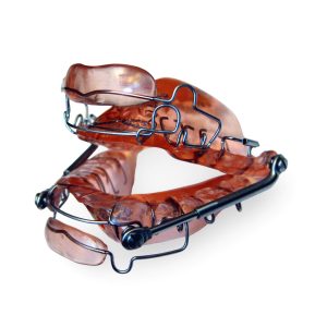 Twin Block with Herbst & Lip Bumpers