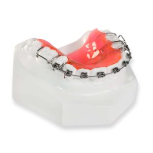 Hawley Retainer with Brackets