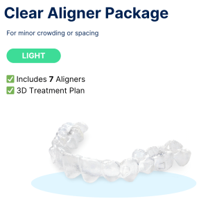 Clear Aligner Package: Light